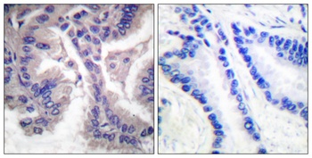 Cleaved-Caspase-6 p18 (D162) antibody