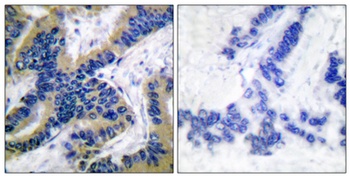 Cleaved-Caspase-6 p18 (D179) rabbit pAb