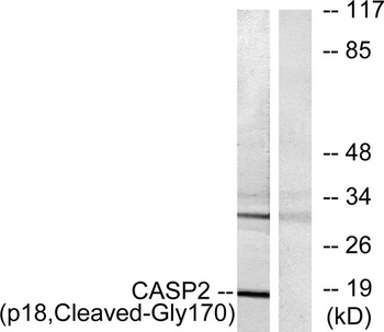 Cleaved-Caspase-2 p18 (G170) antibody