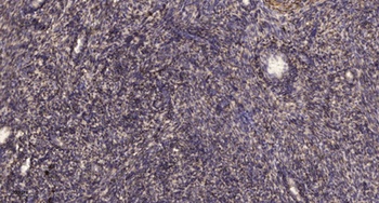 Cleaved-Caspase-4 p20 (Q81) rabbit pAb