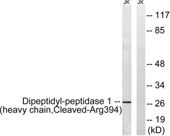 Cleaved-Cathepsin C HC (R394) rabbit pAb