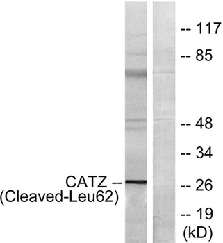 Cleaved-Cathepsin Z (L62) antibody