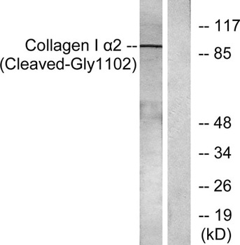 Cleaved-COL1A2 (G1102) rabbit pAb