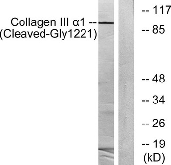 Cleaved-COL3A1 (G1221) rabbit pAb