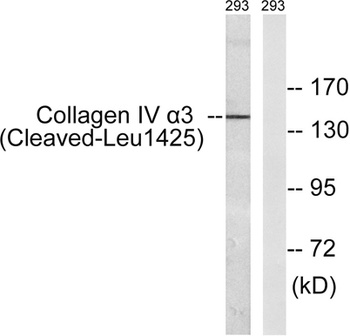 Cleaved-COL4A3 (L1425) rabbit pAb