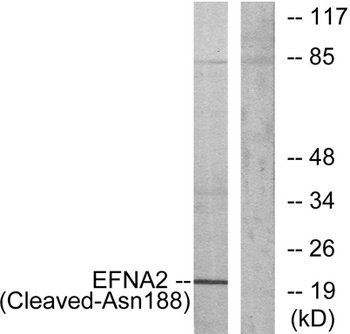 Cleaved-Ephrin-A2 (N188) antibody