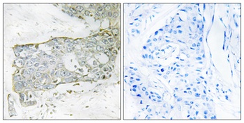 Cleaved-Factor VII LC (R212) rabbit pAb