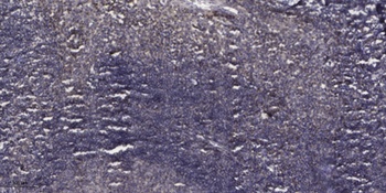Cleaved-Plasma Kallikrein HC (R390) rabbit pAb