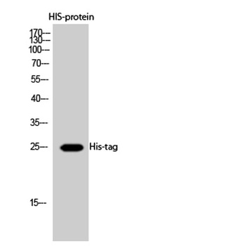 His-tag antibody