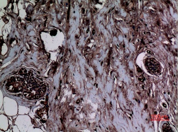 Histone H3 (Mono-Methyl-Lys5) antibody