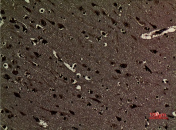 Histone H3 (Di Methyl Lys5) rabbit pAb