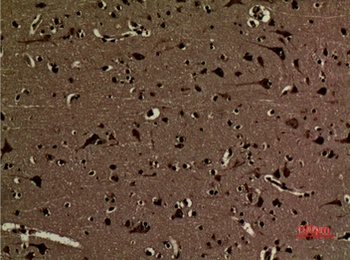 Histone H3 (Di Methyl Lys5) rabbit pAb