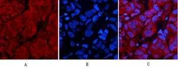p53 (Di Methyl Lys370) rabbit pAb