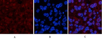 p53 (Di Methyl Lys370) rabbit pAb