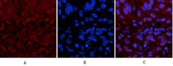 p53 (Di Methyl Lys370) rabbit pAb