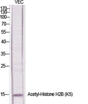 Histone H2B (Acetyl Lys5) rabbit pAb