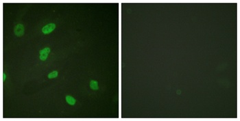 Histone H2B (Acetyl Lys5) rabbit pAb