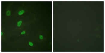 Histone H2B (Acetyl Lys5) antibody