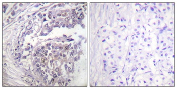 Histone H2B (Acetyl Lys5) rabbit pAb