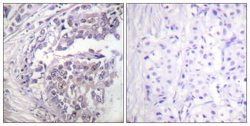 Histone H2B (Acetyl Lys5) antibody