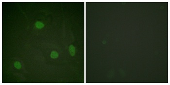 Histone H3 (Acetyl Lys23) antibody