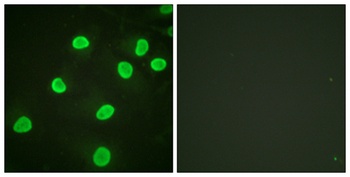 Histone H4 (Acetyl Lys5) antibody