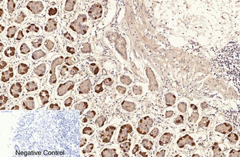 NFκB-p65 (Acetyl Lys310) rabbit pAb