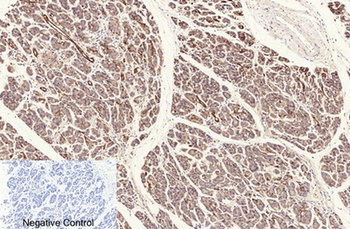 NFκB-p65 (Acetyl Lys310) rabbit pAb