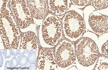 NFκB-p65 (Acetyl Lys310) rabbit pAb