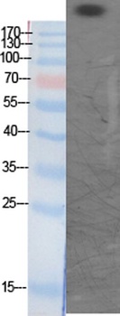CBP (Acetyl Lys1535) rabbit pAb Antibody