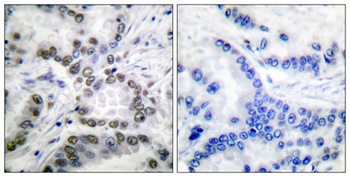 CBP (Acetyl Lys1535) rabbit pAb Antibody