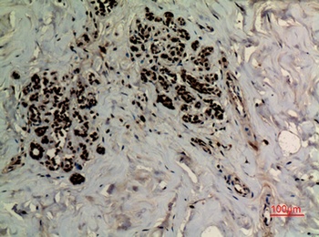 Ref-1 (Acetyl Lys6) rabbit pAb