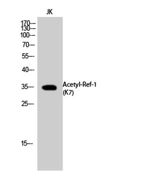 Ref-1 (Acetyl Lys7) rabbit pAb