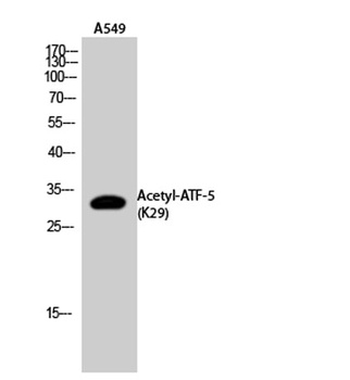 ATF-5 (Acetyl Lys29) rabbit pAb