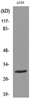 ATF-5 (Acetyl Lys29) rabbit pAb