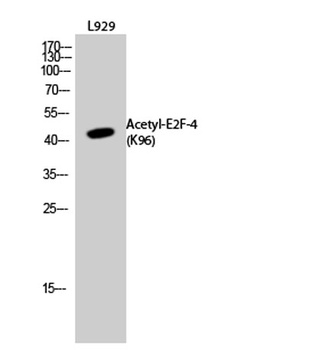 E2F-4 (Acetyl Lys96) rabbit pAb