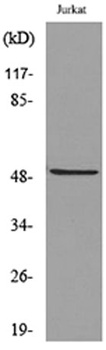 HNF-3alpha/beta/gamma (Acetyl Lys264/253/211) antibody