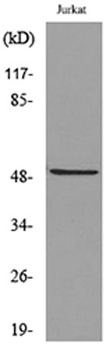 HNF-3α/β/γ (Acetyl Lys264/253/211) rabbit pAb