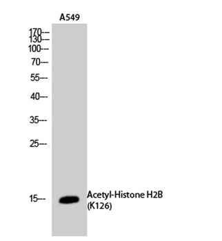 Histone H2B (Acetyl Lys126) rabbit pAb