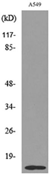 Histone H2B (Acetyl Lys126) rabbit pAb