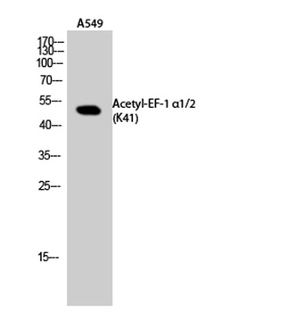 EF-1 alpha1/2 (Acetyl Lys41) antibody