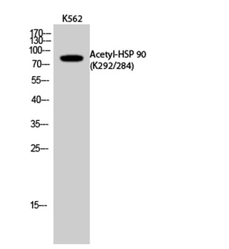 HSP 90 (Acetyl Lys292/284) antibody