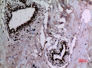 HSP 90 (Acetyl Lys292/284) antibody