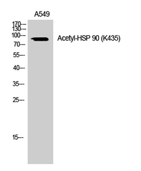 HSP 90 (Acetyl Lys435) rabbit pAb