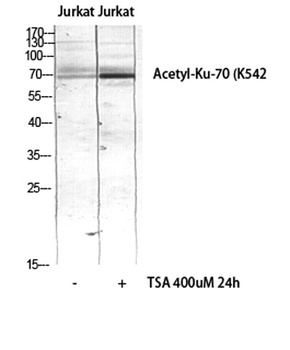 Ku-70 (Acetyl Lys542) antibody