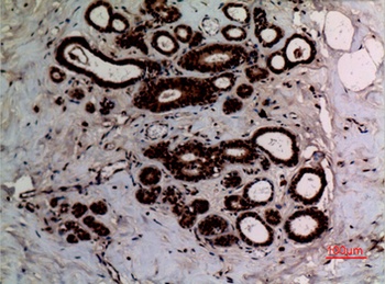 Ku-70 (Acetyl Lys542) rabbit pAb