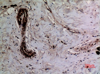 Ku-70 (Acetyl Lys542) rabbit pAb