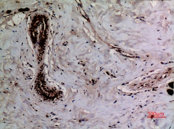 Ku-70 (Acetyl Lys542) antibody