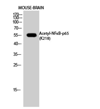 NFκB-p65 (Acetyl Lys218) rabbit pAb