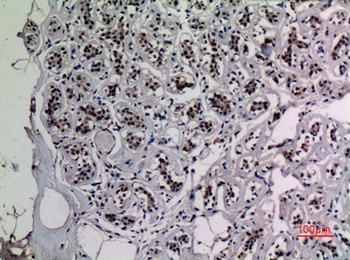 NFκB-p65 (Acetyl Lys218) rabbit pAb